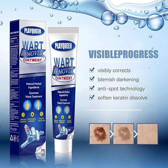 Wart Remover Ointment
