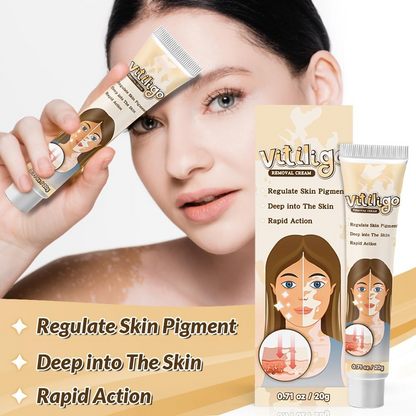 Natural Vitiligo Cream